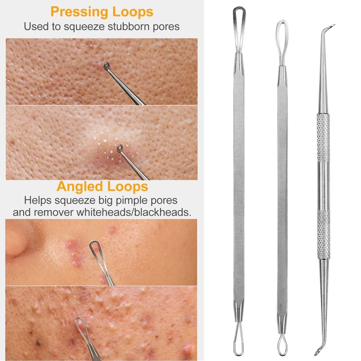 7-Pieces: Blackhead Remover Stainless Steel