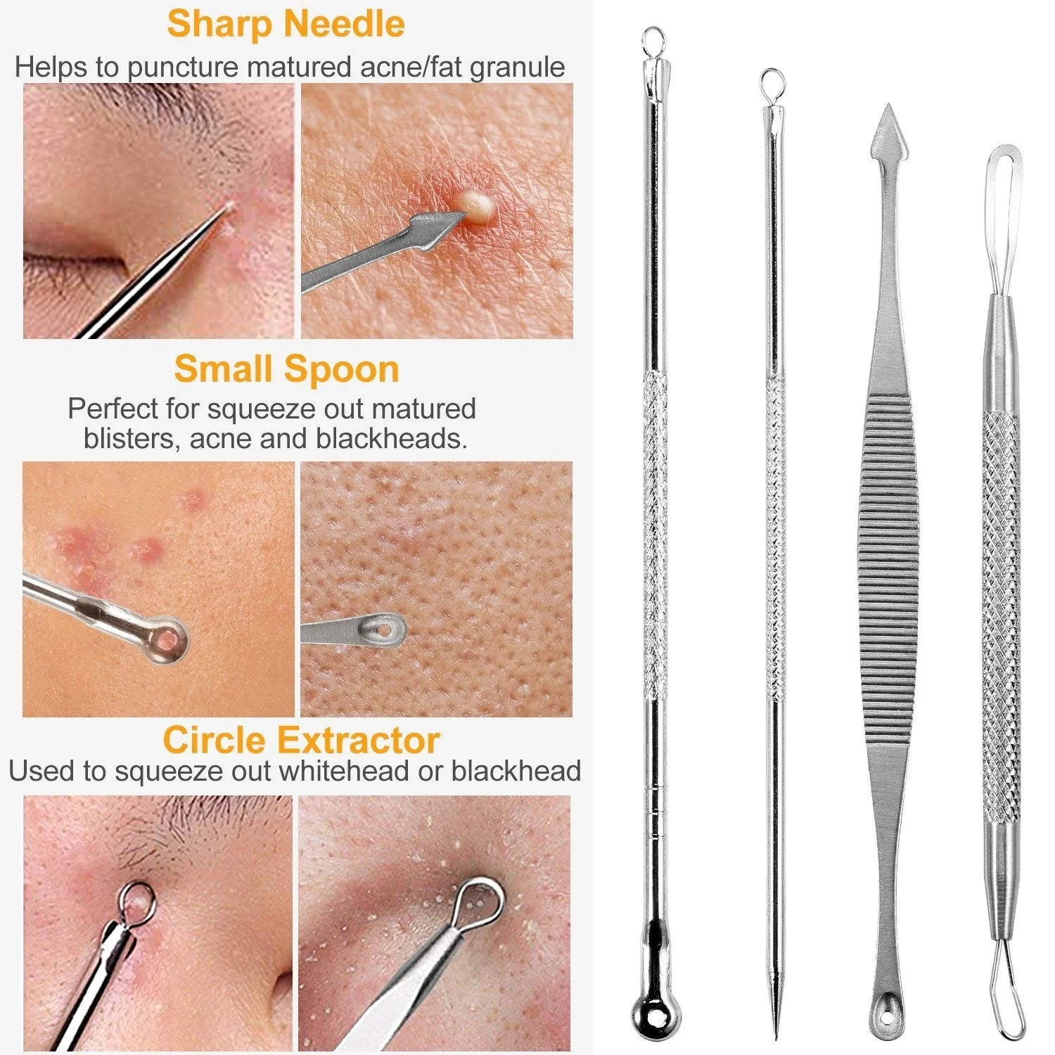 7-Pieces: Blackhead Remover Stainless Steel